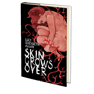 Skin Grows Over by Lucy Elizabeth Allan