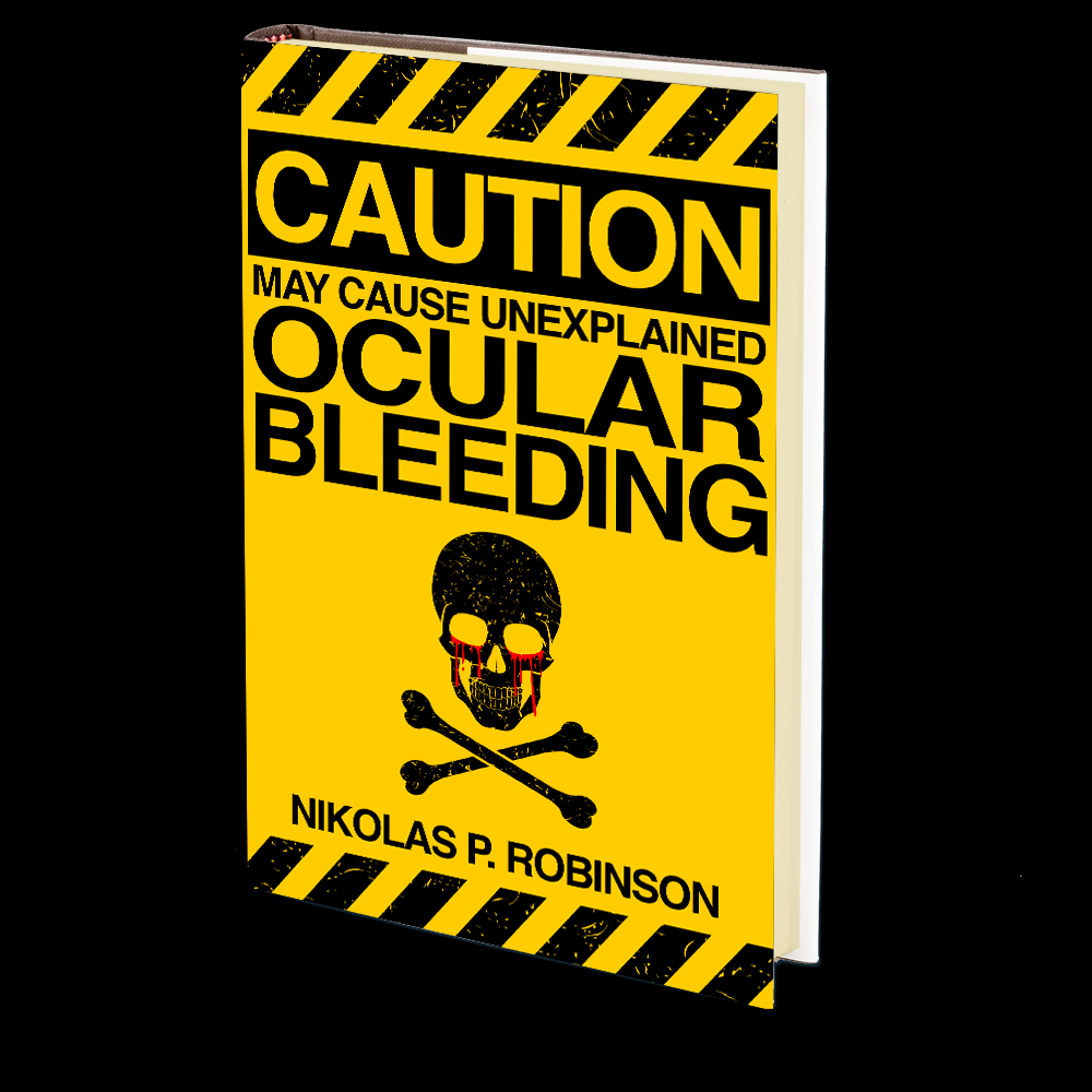 May Cause Unexplained Ocular Bleeding by Nikolas P. Robinson