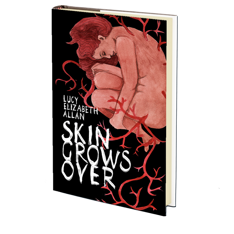 Skin Grows Over by Lucy Elizabeth Allan