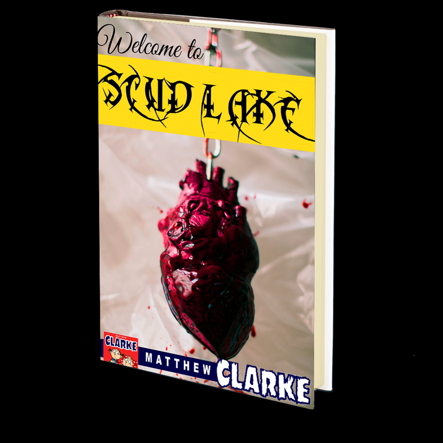 Welcome to Scud Lake by Matthew A. Clarke