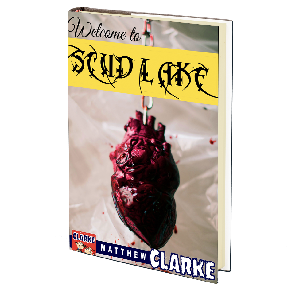 Welcome to Scud Lake by Matthew A. Clarke