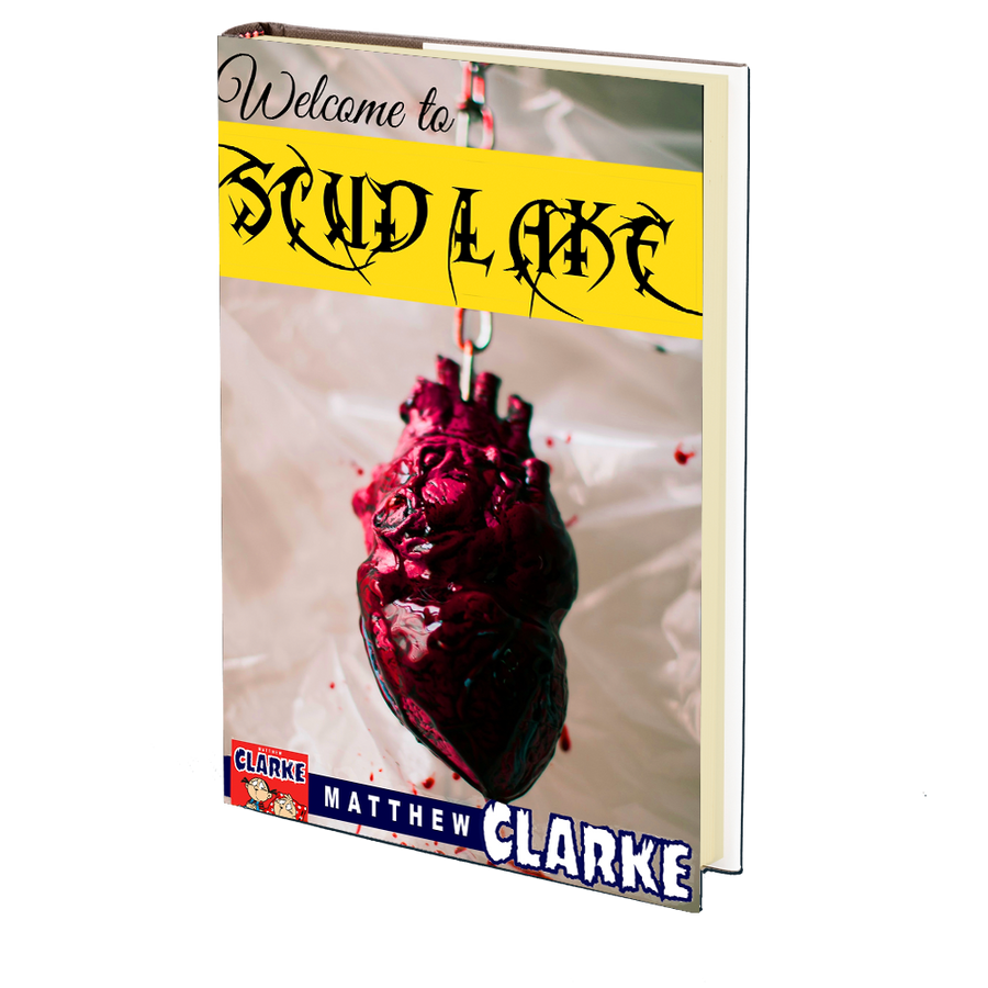 Welcome to Scud Lake by Matthew A. Clarke